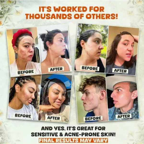 Crema Evil Goods: Noche Reparadora para Piel Joven y Radiante ✨ - Imagen 5